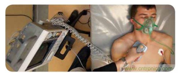 帶電極的醫(yī)院用除顫器。注意，患者身上有外部心電圖或心臟監(jiān)護(hù)儀，從胸部的白色圓片(電極)和導(dǎo)聯(lián)(線)可看出來。