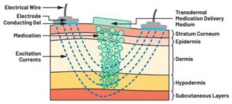  圖5.人體皮膚分層橫截面以及TMD和生物阻抗測量  考慮到生物阻抗分析的無創(chuàng)性，使用兩個金屬電極代表電氣傳感器，連接模擬前端(AFE)電路和患者皮膚。這個金屬與非金屬的接觸點(diǎn)是構(gòu)成整個電路的另一個關(guān)鍵部分，連接了AFE和人體電氣模型。電荷載體（電極中的電子和人體內(nèi)的離子）之間的相互作用可能對這些傳感器的性能產(chǎn)生重大影響，需要根據(jù)每種應(yīng)用進(jìn)行具體考慮。首先，金屬與離子溶液接觸的相互作用導(dǎo)致金屬表面附近溶液中離子濃度的局部變化。這種現(xiàn)象會改變電極下方區(qū)域的電荷中性，導(dǎo)致金屬周圍的電解質(zhì)電位與溶液其余部分不同，從而在金屬和電解質(zhì)主體之間產(chǎn)生一個電位差，即常說的“半電池電位”。其次，注入電流的直流分量會導(dǎo)致電極極化。  表1.各種電極類型和相應(yīng)的半電池電位  金屬及反應(yīng)  半電池電位(V)  Al → Al3+ + 3e- Al → Al3+ + 3e-  –1.706 –1.706  Ni → Ni2+ + 2e- Ni → Ni2+ + 2e-  –0.230 -0.230  H2 → 2H+ + 2e- H2 → 2H+ + 2e-  0.000 (by definition) 0.000（根據(jù)定義）  Ag + Cl- → AgCl + e- Ag + Cl- → AgCl + e-  +0.223 +0.223  Ag → Ag+ + e- Ag → Ag+ + e-  +0.799 +0.799  Au → Au+ + e- Au → Au+ + e-  +1.680 +1.680  這是一種不良現(xiàn)象，往往導(dǎo)致電極性能下降。這些考量表明，電極也需要定義適當(dāng)?shù)碾姎饽Ｐ停▍⒁妶D6）。我們可以將干電極表示為具有三個串聯(lián)元件的電路：一個用于模擬半電池電位(EHC)的直流電源；一個用于模擬金屬和非金屬（人體）之間接觸的RC并聯(lián)電池(Rd||Cd)；以及一個用于模擬電極金屬的電阻Rs。